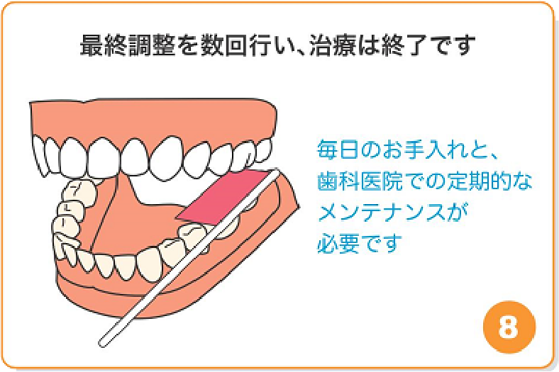 最終調整を数回行い、治療は終了です