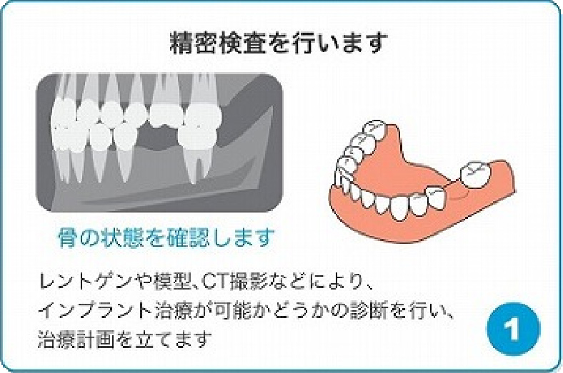 精密検査を行います