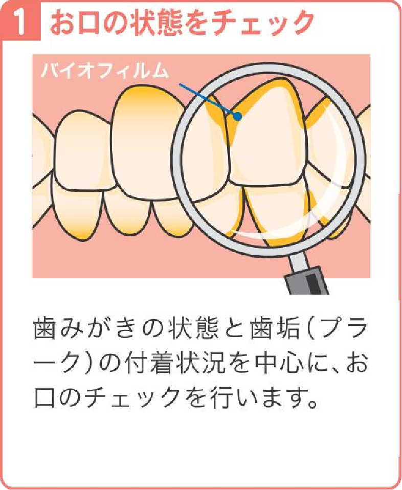 お口の状態をチェック